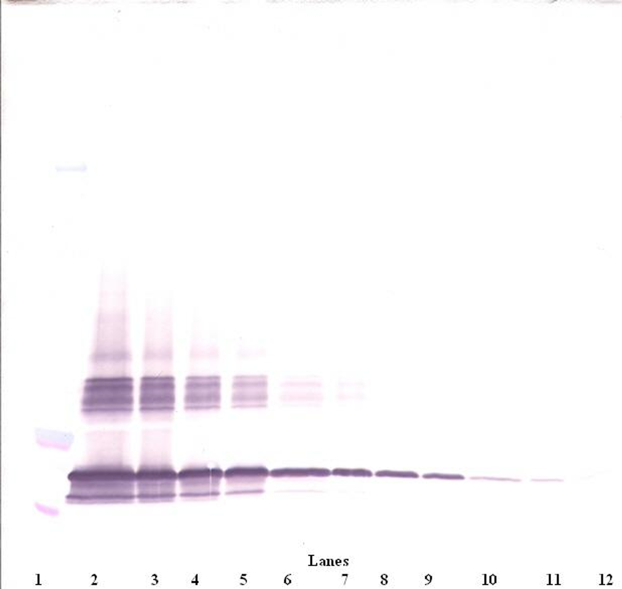 To detect mSF-20 by Western Blot analysis this antibody can be used at a concentration of 0.1 - 0.2 ug/ml. Used in conjunction with compatible secondary reagents the detection limit for recombinant mSF-20 is 1.5 - 3.0 ng/lane, under either reducing or non-reducing conditions.