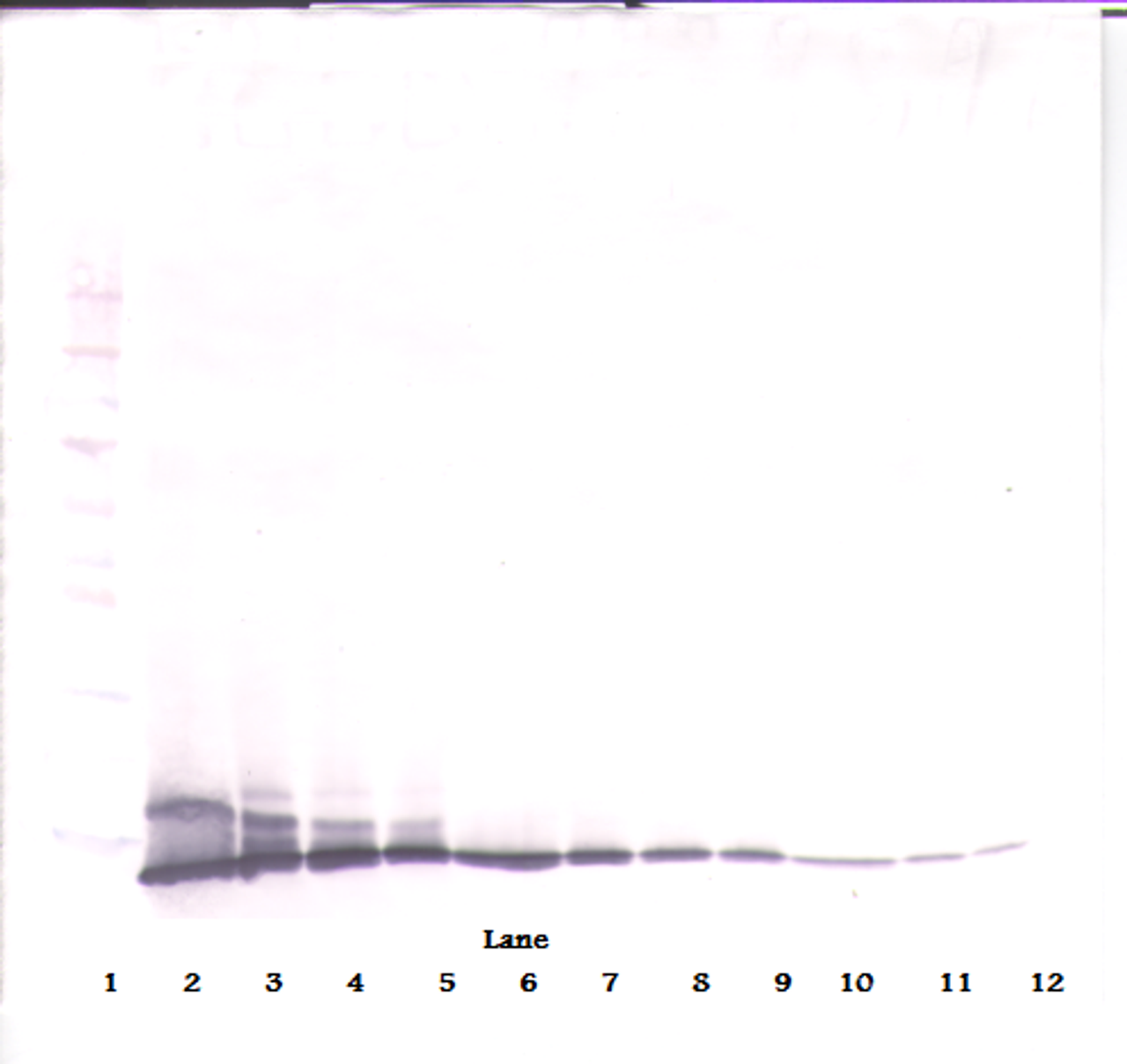 To detect Rat IL-2 by Western Blot analysis this antibody can be used at a concentration of 0.1 - 0.2 ug/ml. Used in conjunction with compatible secondary reagents the detection limit for recombinant Rat IL-2 is 1.5 - 3.0 ng/lane, under either reducing or non-reducing conditions.