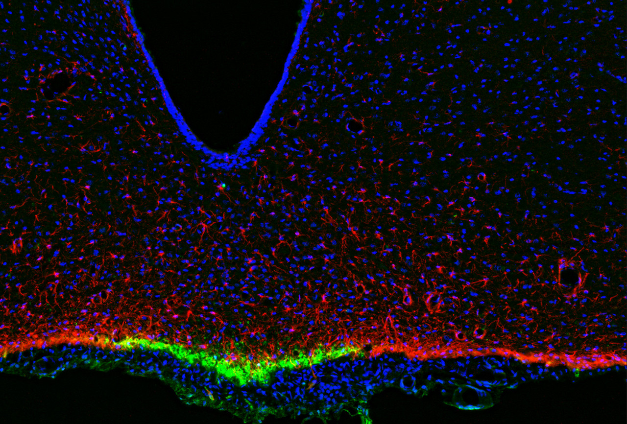This antibody stained colchicine injected rat brain (including the cortex and median eminence) tissue. The primary antibody was incubated at 0.25 mg/ml overnight at 4˚C. This was followed by a peroxidase conjugated secondary antibody and then a fluorescein Tyramide Signal Amplification (TSA) reagent. Optimal concentrations and conditions may vary.