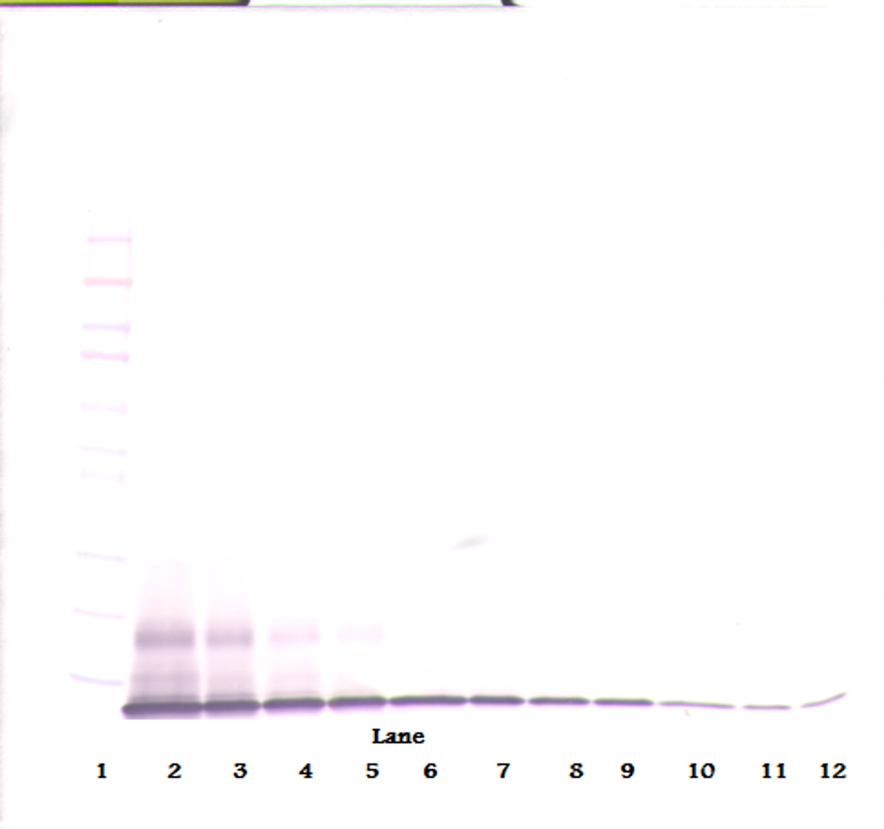 To detect Rat IP-10 by Western Blot analysis this antibody can be used at a concentration of 0.1 - 0.2 ug/ml. Used in conjunction with compatible secondary reagents the detection limit for recombinant Rat IP-10 is 1.5 - 3.0 ng/lane, under either reducing or non-reducing conditions.