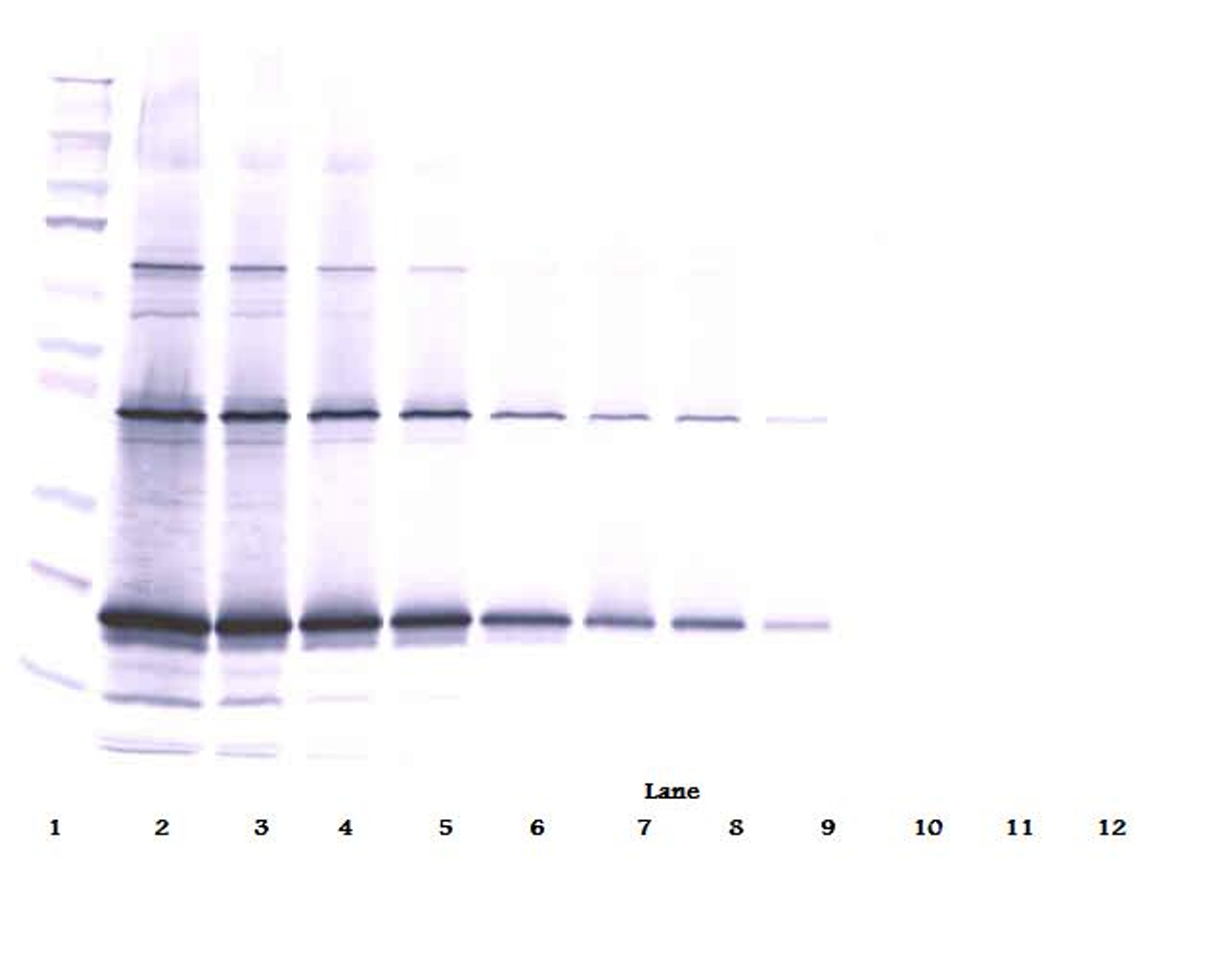 To detect Murine TRAIL by Western Blot analysis this antibody can be used at a concentration of 0.1 - 0.2 mg/ml. When used in conjunction with compatible development reagents the detection limit for recombinant Murine TRAIL is 1.5 – 3.0 ng/lane, under either reducing or non-reducing conditions.