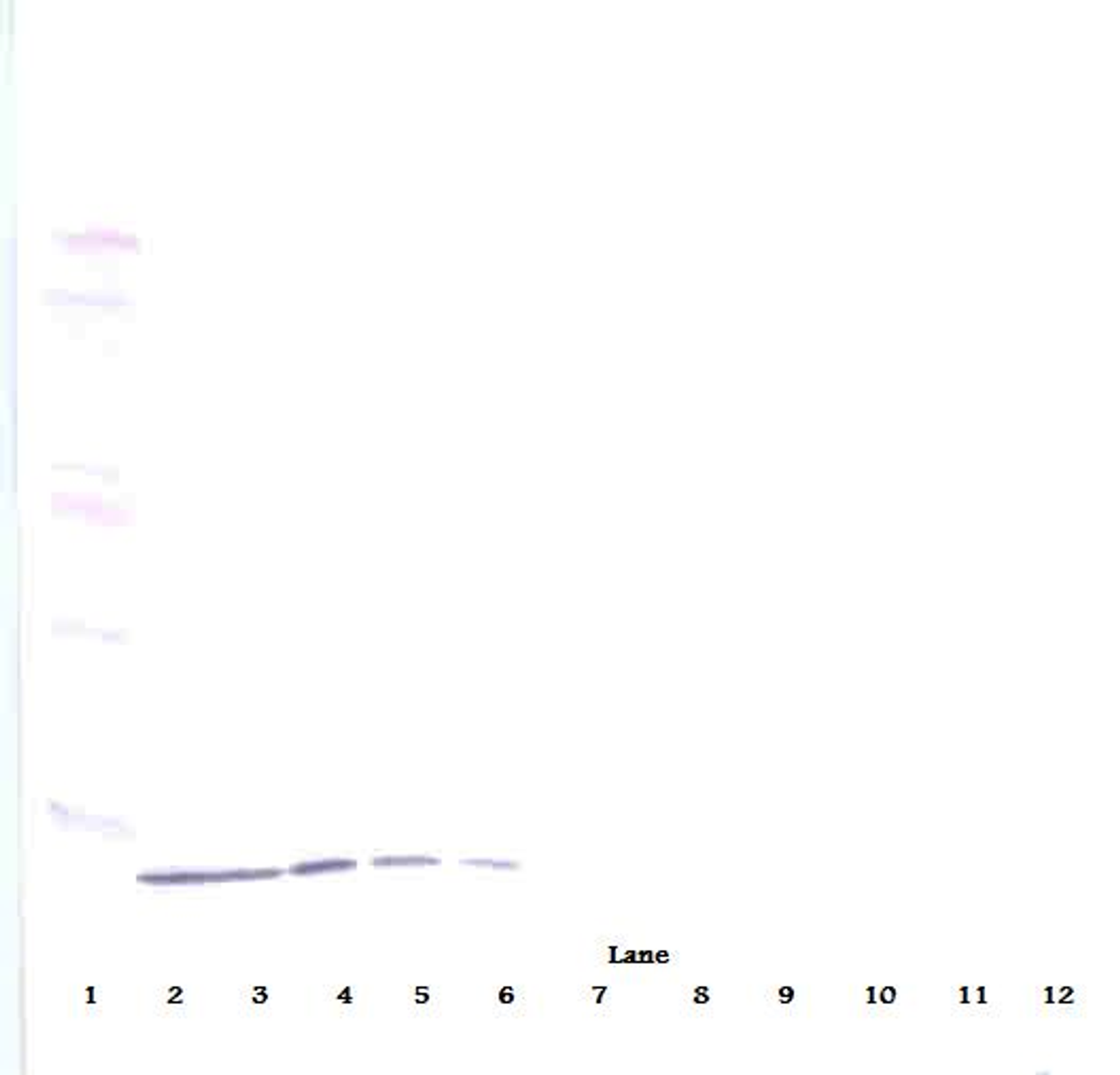 To detect Human IP-10 by Western Blot analysis this antibody can be used at a concentration of 0.25-0.50 ug/ml (non-reducing) or at a concentration of 1.0-2.0 ug/ml (reducing) . When used in conjunction with compatible secondary reagents the detection limit for recombinant Human IP-10 is 0.20-0.40 ng/lane under non-reducing conditions and 2.00-4.00 ng/lane under reducing conditions.