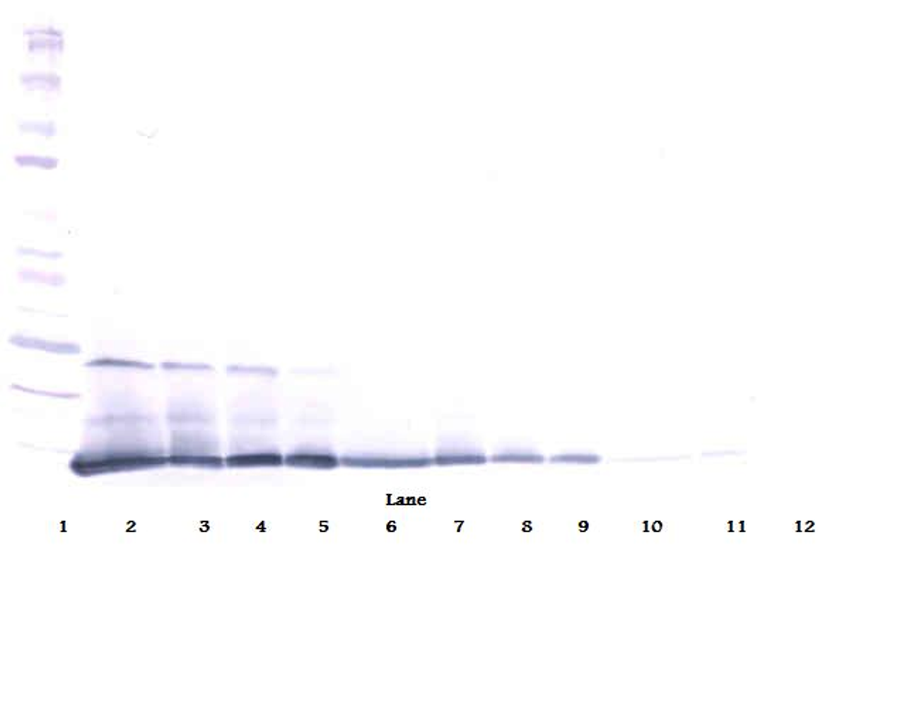 To detect Murine IL-5 by Western Blot analysis this antibody can be used at a concentration of 0.1 - 0.2 ug/ml. When used in conjunction with compatible secondary reagents, the detection limit for recombinant Murine IL-5 is 1.5 - 3.0 ng/lane, under either reducing or non-reducing conditions.