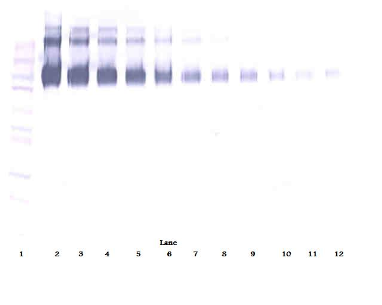 To detect Human EGF Receptor by Western Blot analysis this antibody can be used at a concentration of 0.1 - 0.2 ug/ml. When used in conjunction with compatible secondary reagents, the detection limit for recombinant Human EGF Receptor is 1.5 - 3.0 ng/lane, under either reducing or non-reducing conditions.