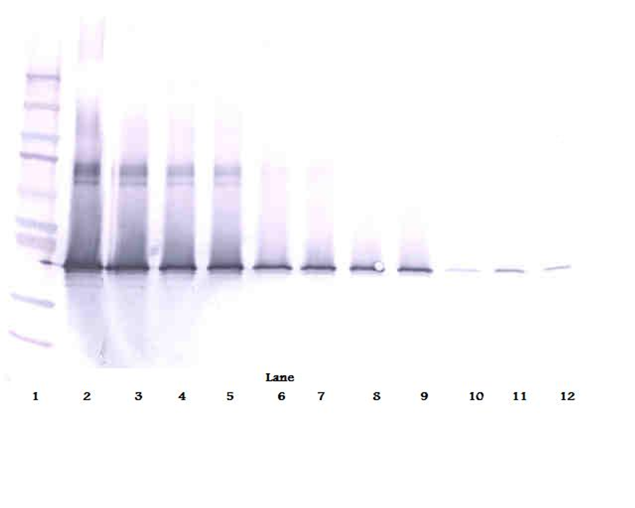 To detect Human IL-17D by Western Blot analysis this antibody can be used at a concentration of 0.1 - 0.2 mg/ml. when used in conjunction with compatible development reagents the detection limit for recombinant Human IL-17D is 1.5 – 3.0 ng/lane, under either reducing or non-reducing conditions.