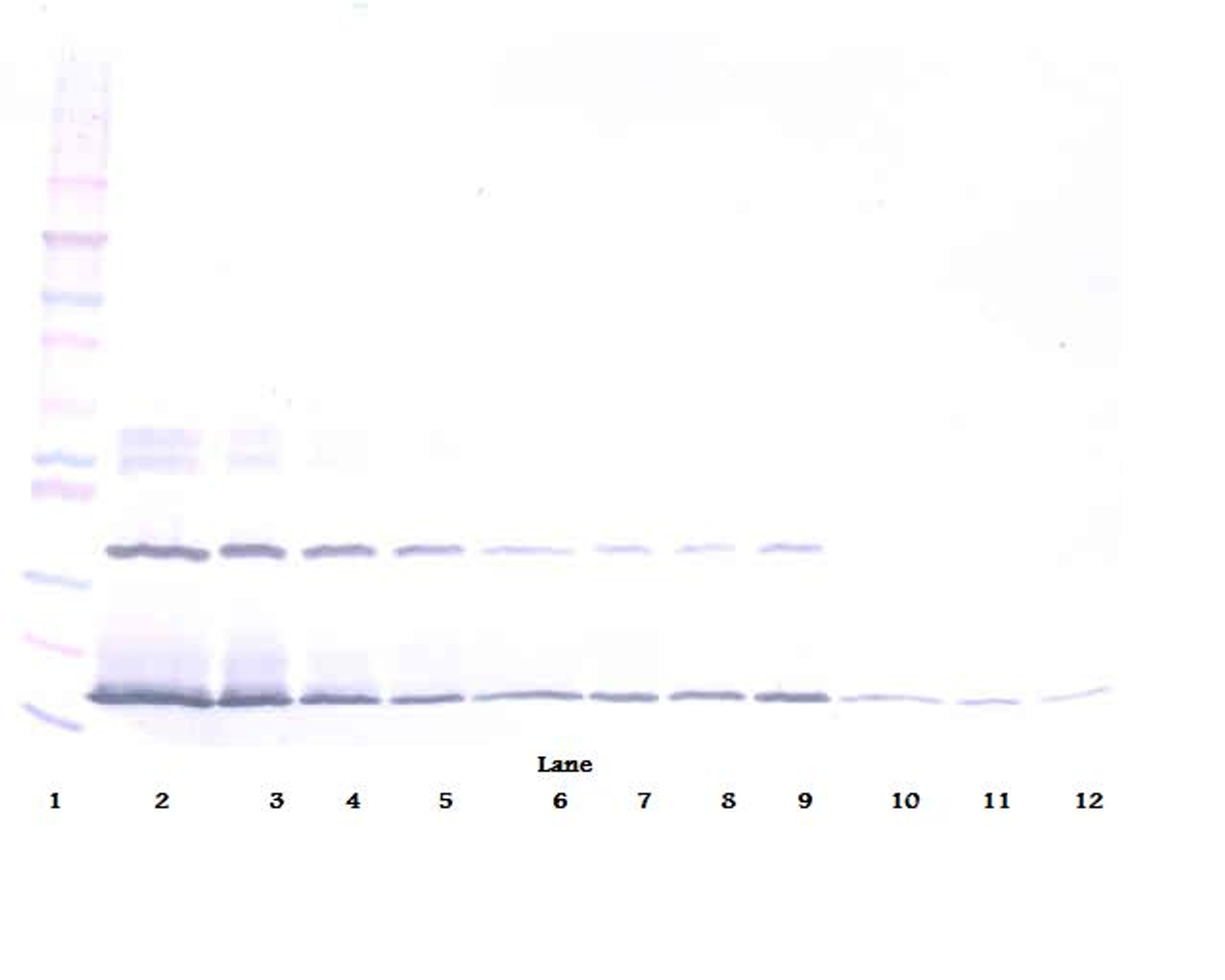 To detect Human IFN-λ2 by Western Blot analysis this antibody can be used at a concentration of 0.1 - 0.2 ug/ml. When used in conjunction with compatible secondary reagents, the detection limit for recombinant Human IFN-λ2 is 1.5 - 3.0 ng/lane, under either reducing or non-reducing conditions.