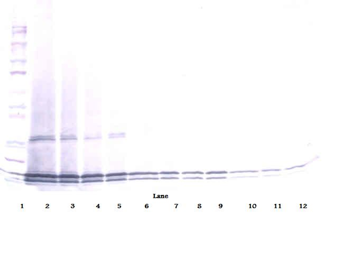 To detect hIL-17B by Western Blot analysis this antibody can be used at a concentration of 0.1 - 0.2 ug/ml. Used in conjunction with compatible secondary reagents the detection limit for recombinant hIL-17B is 1.5 - 3.0 ng/lane, under either reducing or non-reducing conditions.