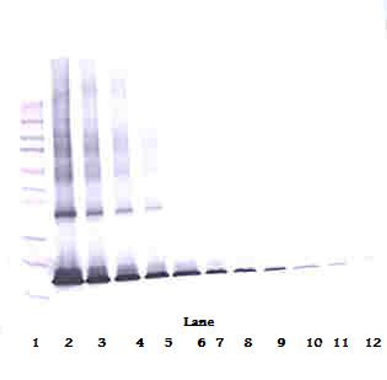 To detect Human IL-1RA by Western Blot analysis this antibody can be used at a concentration of 0.1 - 0.2 ug/ml. Used in conjunction with compatible secondary reagents the detection limit for recombinant Human IL-1RA is 1.5 - 3.0 ng/lane, under either reducing or non-reducing conditions.