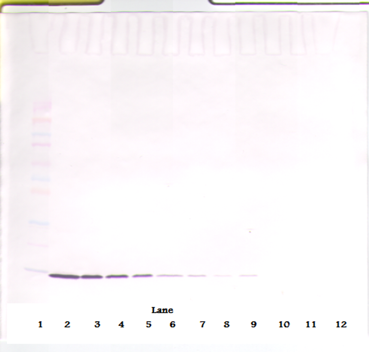 To detect rat IL-2 by Western Blot analysis this antibody can be used at a concentration of 0.25-0.50 ug/ml. When used in conjunction with compatible secondary reagents the detection limit for recombinant rat IL-2 is 2.0-4.0 ng/lane, under reducing or non-reducing conditions.