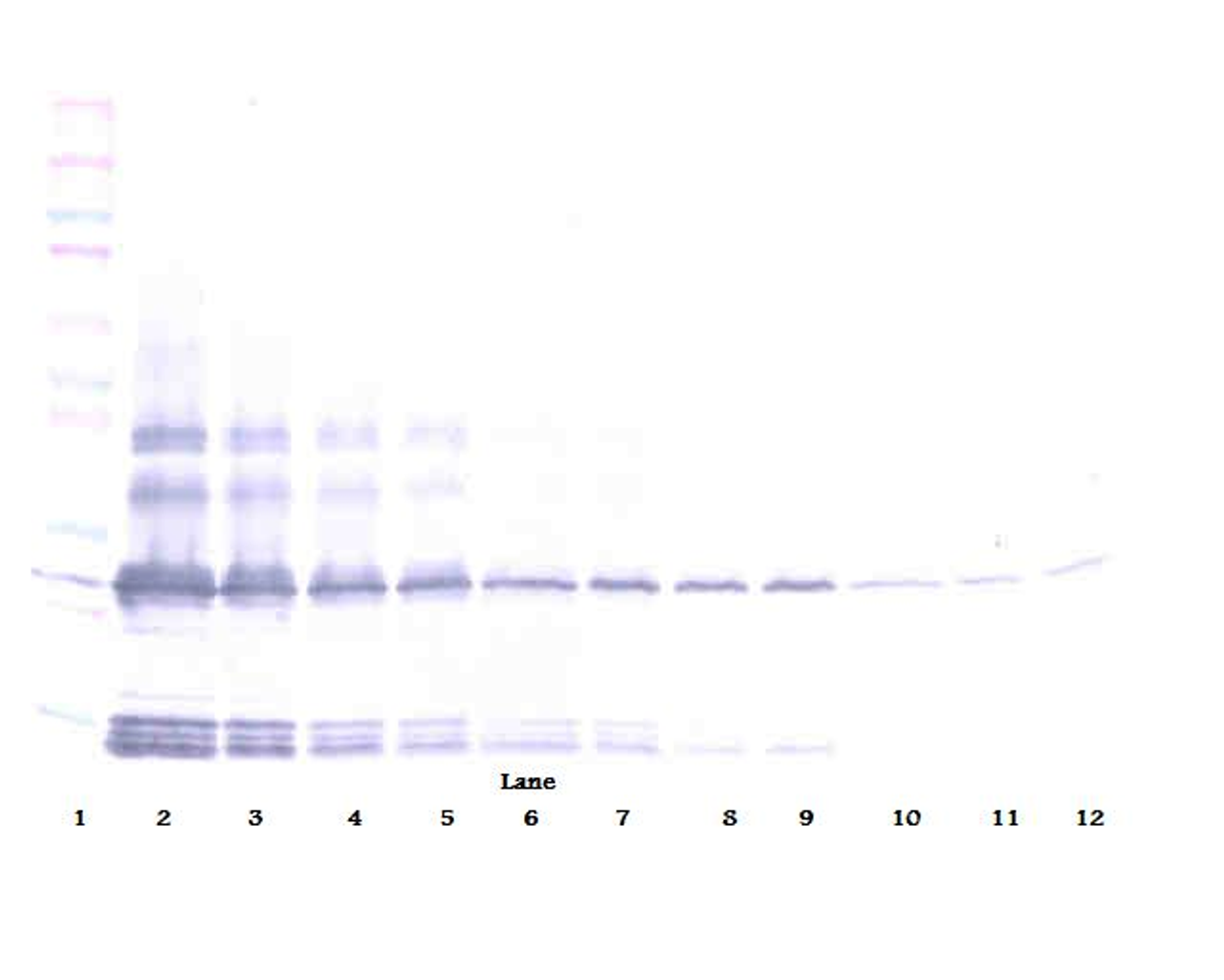 To detect hBMP-2 by Western Blot analysis this antibody can be used at a concentration of 0.1 - 0.2 mg/ml. Used in conjunction with compatible secondary reagents the detection limit for recombinant hBMP-2 is 1.5 - 3.0 ng/lane, under either reducing or non-reducing conditions.