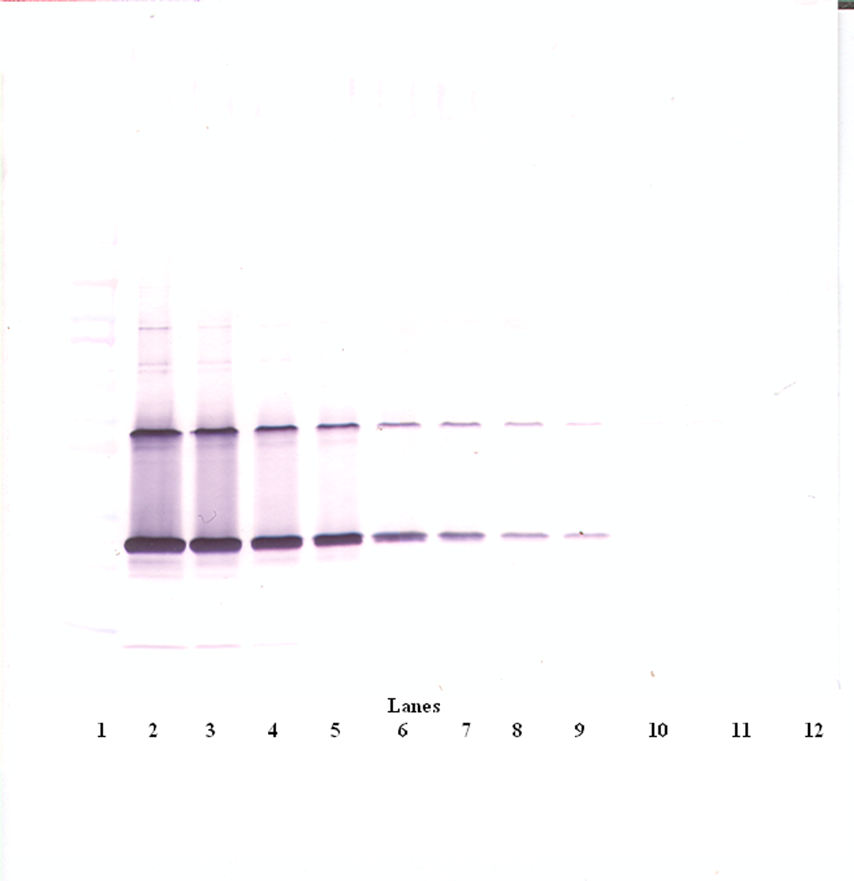 To detect hCNTF by Western Blot analysis this antibody can be used at a concentration of 0.1-0.2 ug/ml. Used in conjunction with compatible secondary reagents the detection limit for recombinant hCNTF is 1.5-3.0 ng/lane, under either reducing or non-reducing conditions.