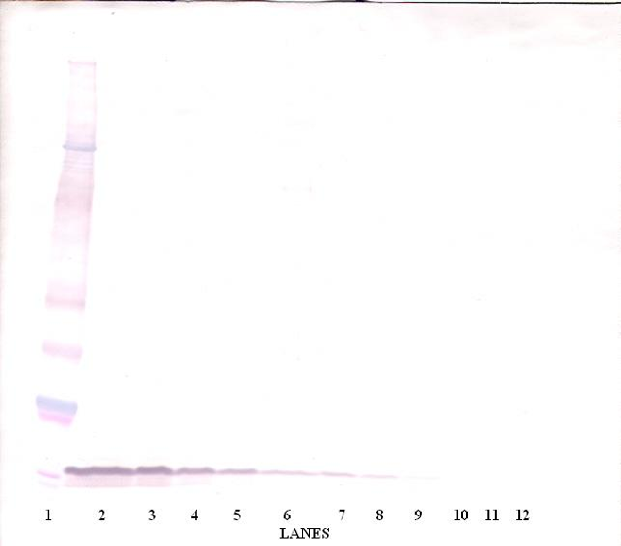 To detect mEGF by Western Blot analysis this antibody can be used at a concentration of 0.1- 0.2 ug/ml. Used in conjunction with compatible secondary reagents the detection limit for recombinant mEGF is 1.5-3.0 ng/lane, under either reducing or non-reducing conditions.