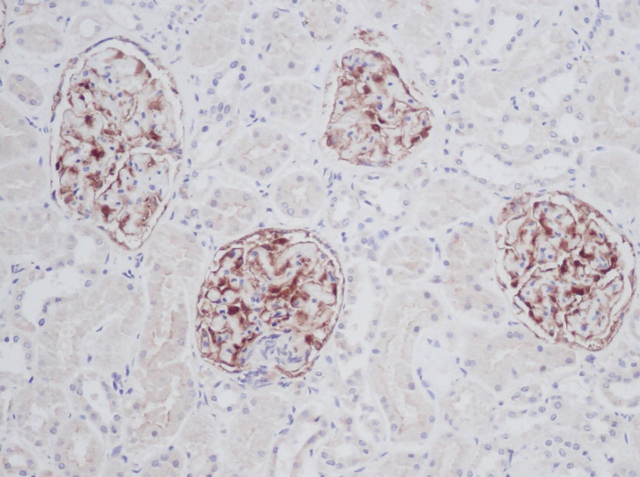 This antibody stained formalin-fixed, paraffin-embedded sections of human normal kidney. The recommended concentration is 0.050 ug/ml-0.125 ug/ml with an overnight incubation at 4&#730;C. An HRP-labeled polymer detection system was used with a DAB chromogen. Heat induced antigen retrieval with a pH 6.0 sodium citrate buffer is recommended. Optimal concentrations and conditions may vary.