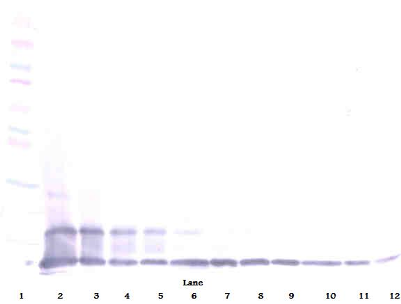 To detect hFractalkine by Western Blot analysis this antibody can be used at a concentration of 0.1-0.2 ug/ml. Used in conjunction with compatible secondary reagents the detection limit for recombinant hFractalkine is 1.5-3.0 ng/lane, under either reducing or non-reducing conditions.