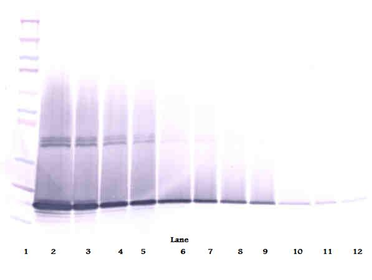 To detect mG-CSF by Western Blot analysis this antibody can be used at a concentration of 0.1-0.2 ug/ml. Used in conjunction with compatible secondary reagents the detection limit for recombinant mG-CSF is 1.5-3.0 ng/lane, under either reducing or non-reducing conditions.