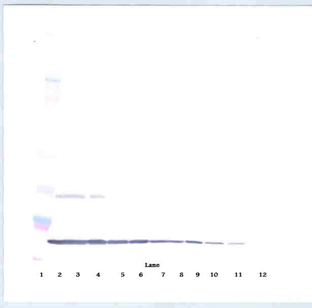 To detect hIL-10 by Western Blot analysis this antibody can be used at a concentration of 0.1 - 0.2 ug/ml. Used in conjunction with compatible secondary reagents the detection limit for recombinant hIL-10 is 1.5 - 3.0 ng/lane, under either reducing or non-reducing conditions.