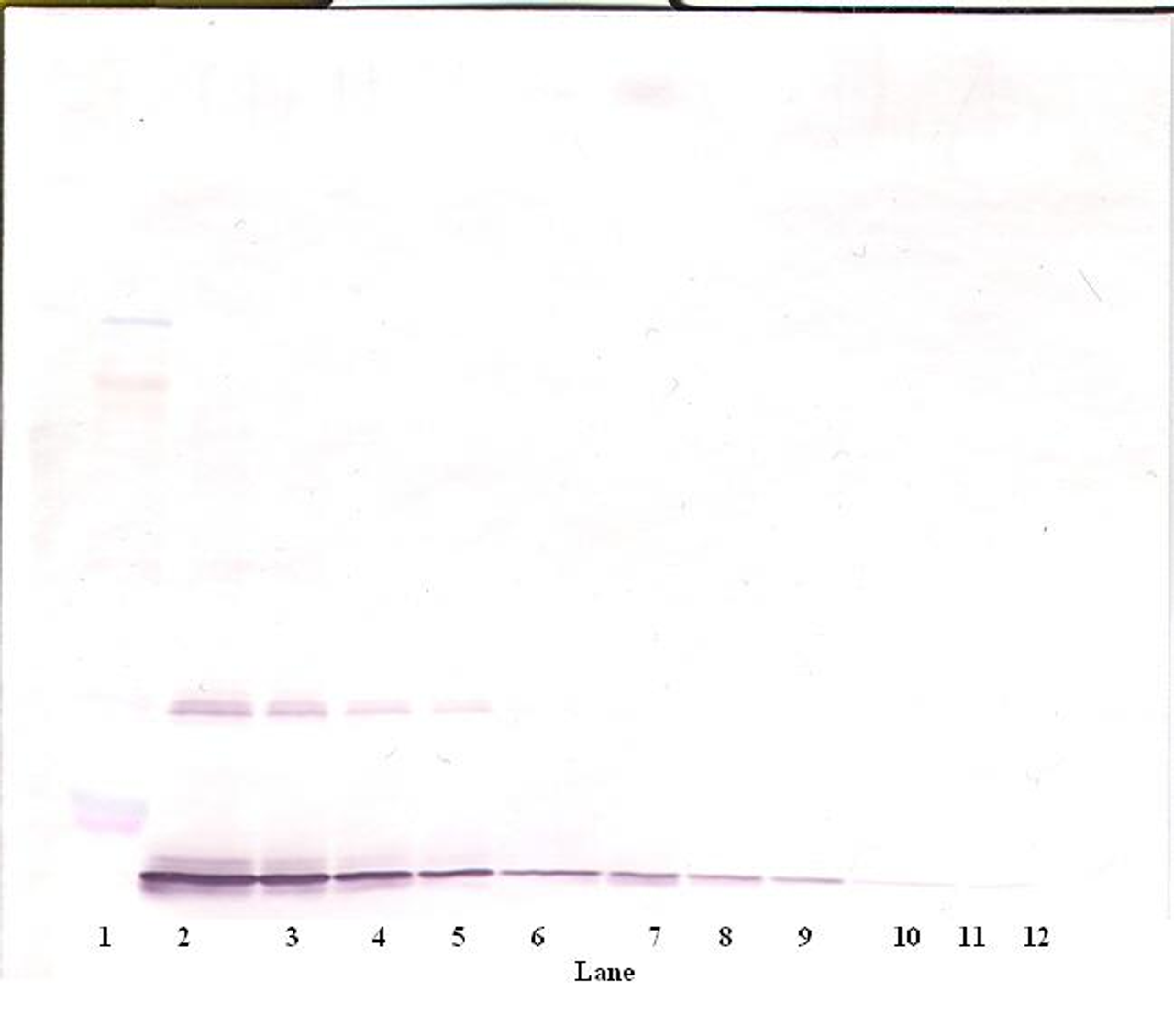 To detect Rat IL-10 by Western Blot analysis this antibody can be used at a concentration of 0.1-0.2 ug/ml. Used in conjunction with compatible secondary reagents the detection limit for recombinant Rat IL-10 is 1.5-3.0 ng/lane, under either reducing or non-reducing conditions.