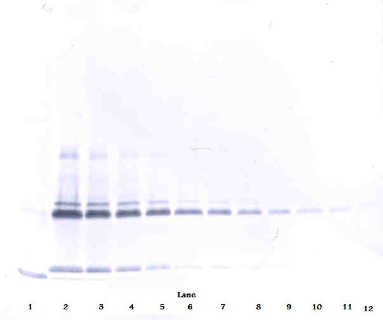 To detect hIL-17A by Western Blot analysis this antibody can be used at a concentration of 0.1 - 0.2 ug/ml. Used in conjunction with compatible secondary reagents the detection limit for recombinant hIL-17A is 1.5 - 3.0 ng/lane, under either reducing or non-reducing conditions.