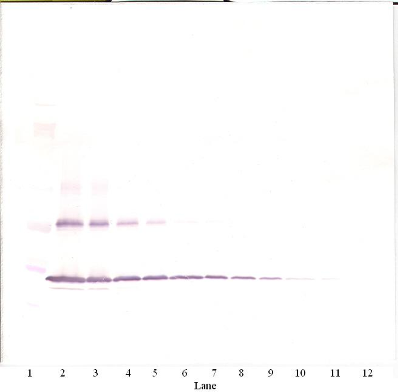 To detect mIL-1-beta by Western Blot analysis this antibody can be used at a concentration of 0.1-0.2 ug/ml. Used in conjunction with compatible secondary reagents the detection limit for recombinant mIL-1-beta is 1.5-3.0 ng/lane, under either reducing or non-reducing conditions.