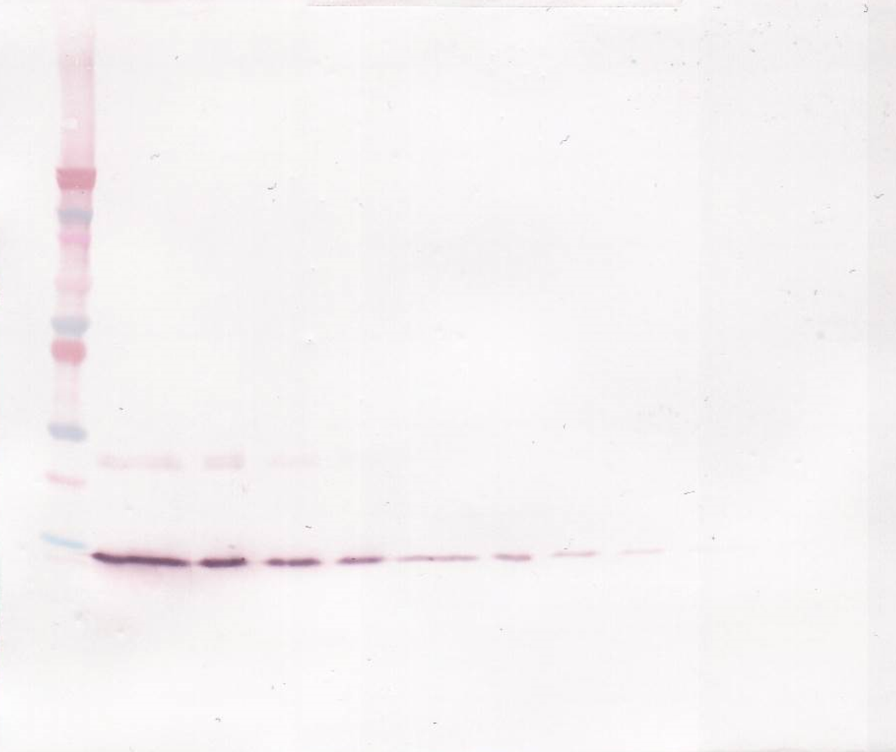 To detect Rat IL-4 by Western Blot analysis this antibody can be used at a concentration of 0.1-0.2 ug/ml. When used in conjunction with compatible secondary reagents, the detection limit for recombinant Rat IL-4 is 1.5-3.0 ng/lane, under either reducing or non-reducing conditions.