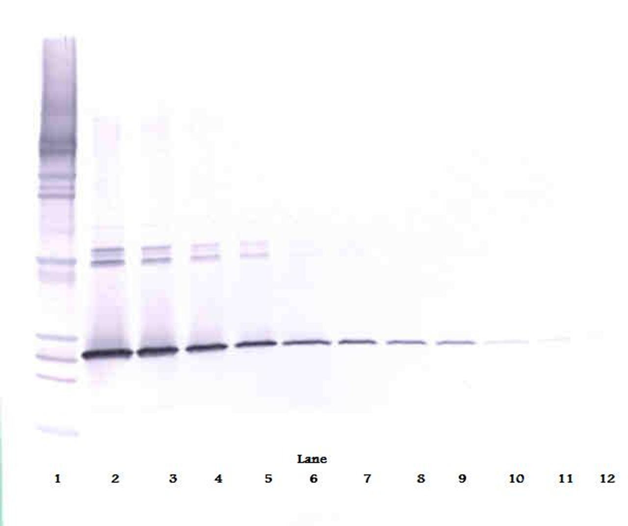 To detect Human IL-5 by Western Blot analysis this antibody can be used at a concentration of 0.1 - 0.2 ug/ml. When used in conjunction with compatible secondary reagents, the detection limit for recombinant Human IL-5 is 1.5 - 3.0 ng/lane, under either reducing or non-reducing conditions.