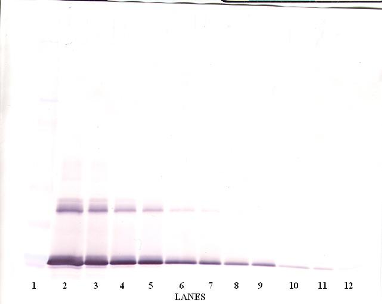 To detect Murine IL-6 by Western Blot analysis this antibody can be used at a concentration of 0.1-0.2 ug/ml. When used in conjunction with compatible secondary reagents, the detection limit for recombinant Murine IL-6 is 1.5-3.0 ng/lane, under either reducing or non-reducing conditions.