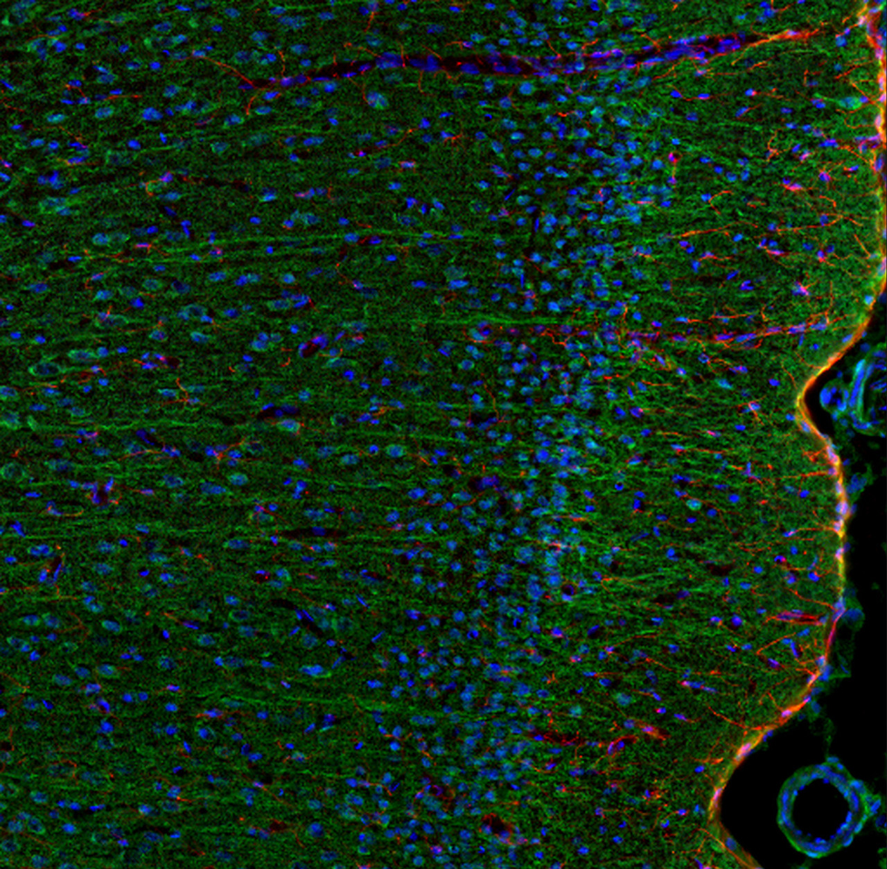 This antibody stained colchicine injected rat brain (cingulate cortex) tissue. The primary antibody was incubated at 1.0 ug/ml overnight at 4˚C. This was followed by a peroxidase conjugated secondary antibody and then a fluorescein Tyramide Signal Amplification (TSA) reagent. Optimal concentrations and conditions may vary.