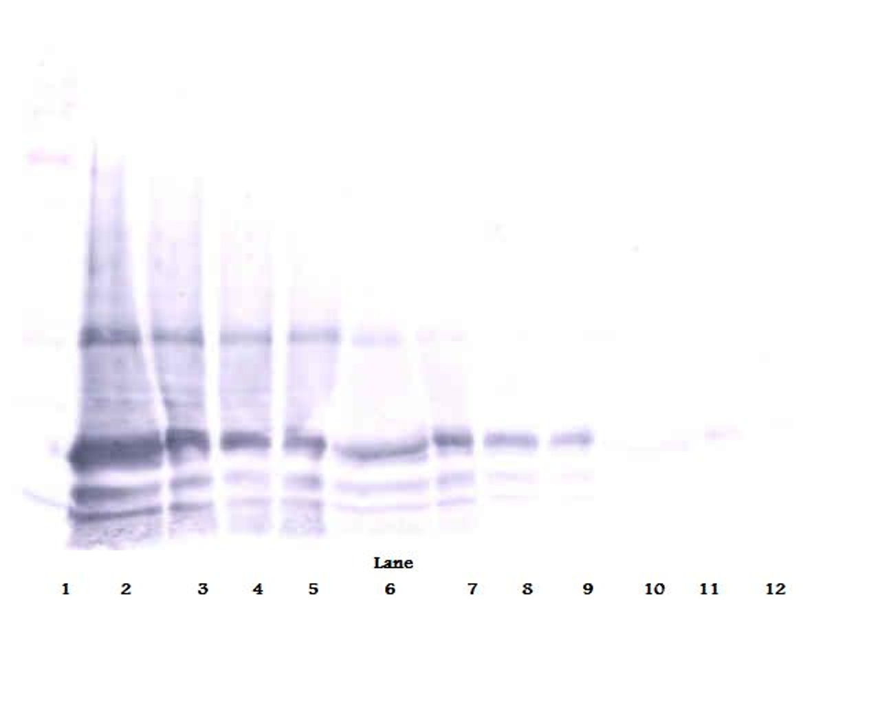 To detect Rat IL-6 by Western Blot analysis this antibody can be used at a concentration of 0.1- 0.2 ug/ml. When used in conjunction with compatible secondary reagents, the detection limit for recombinant Rat IL-6 is 1.5-3.0 ng/lane, under either reducing or non-reducing conditions.