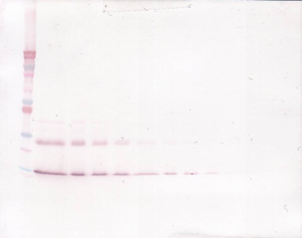 To detect Murine IL-9 by Western Blot analysis this antibody can be used at a concentration of 0.1-0.2 ug/ml. When used in conjunction with compatible secondary reagents, the detection limit for recombinant Murine IL-9 is 1.5-3.0 ng/lane, under either reducing or non-reducing conditions.