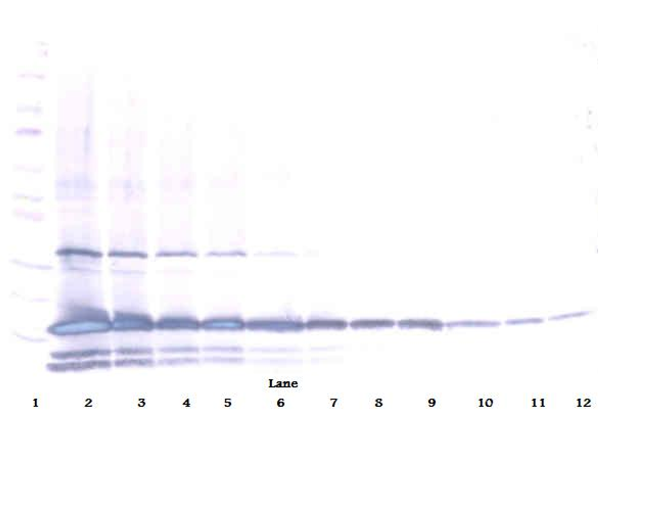 To detect Human IL-17E by Western Blot analysis this antibody can be used at a concentration of 0.1 - 0.2 ug/ml.nbsp; When used in conjunction with compatible secondary reagents the detection limit for recombinant Human IL-17E is 1.5 - 3.0 ng/lane, under either reducing or non-reducing conditions.