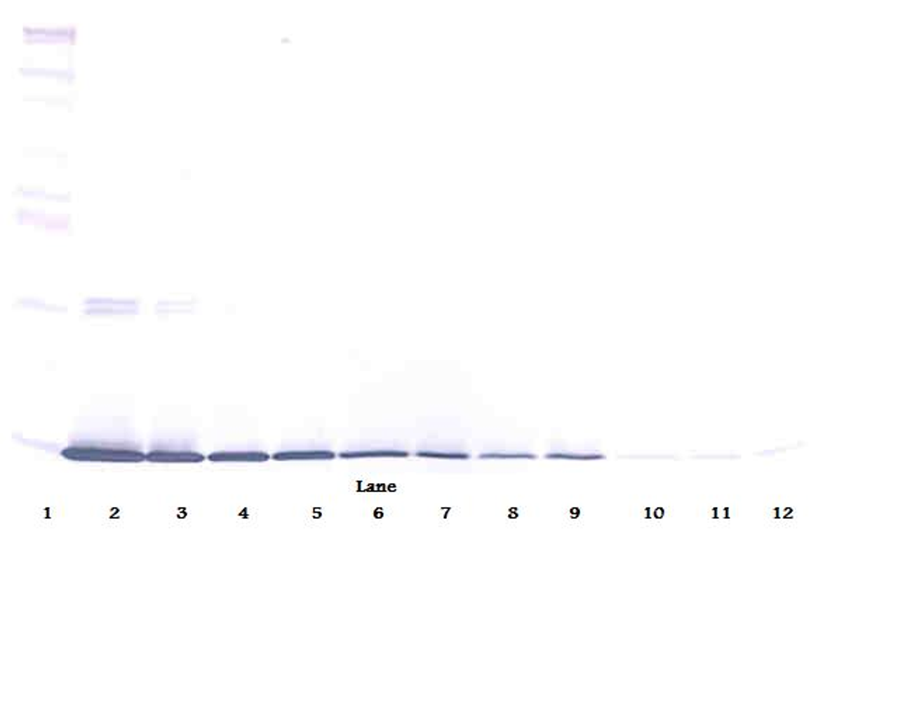 To detect Rat Leptin by Western Blot analysis this antibody can be used at a concentration of 0.1 - 0.2 ug/ml. Used in conjunction with compatible secondary reagents the detection limit for recombinant Rat Leptin is 1.5 - 3.0 ng/lane, under either reducing or non-reducing conditions.