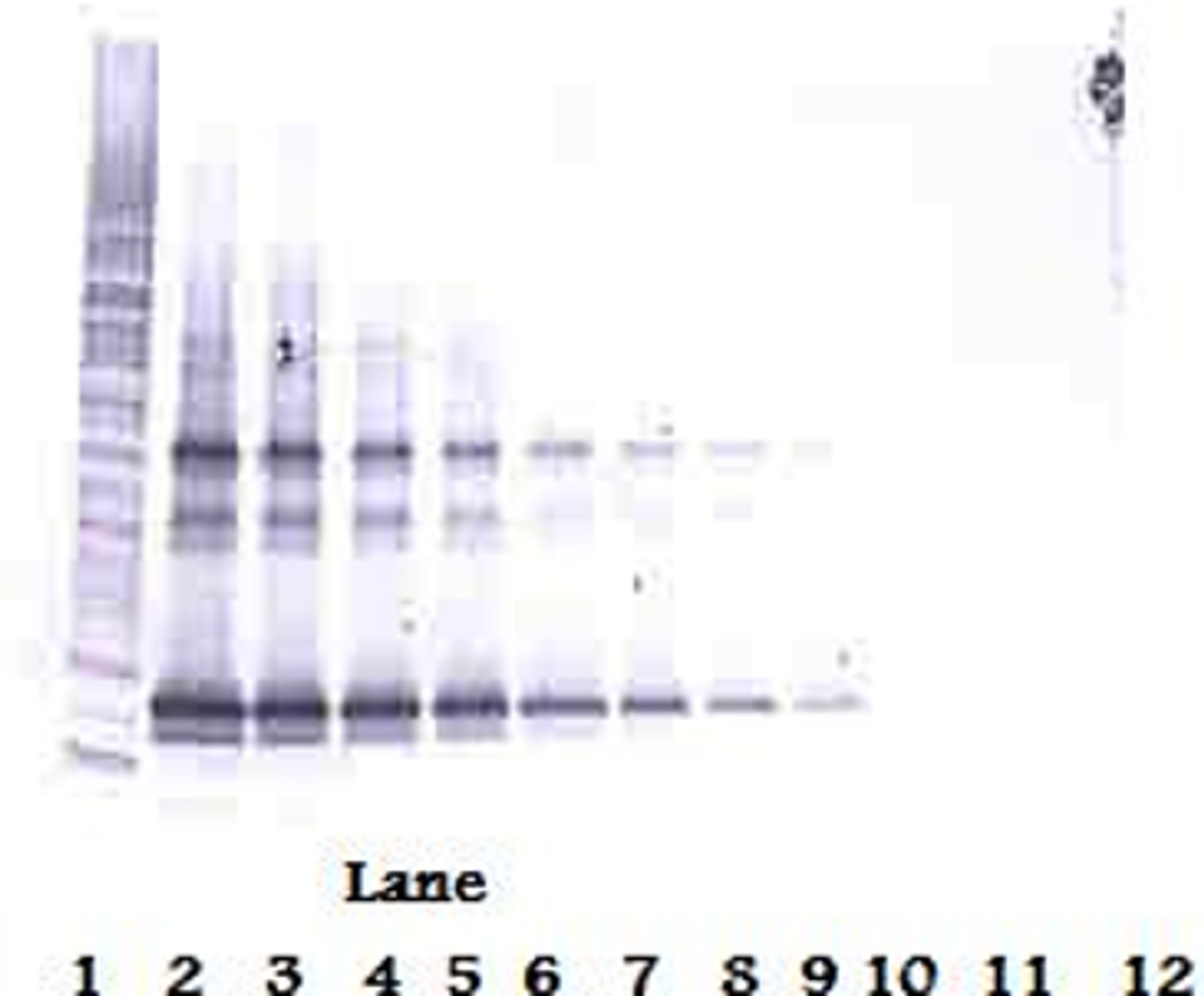 To detect hLIGHT by Western Blot analysis this antibody can be used at a concentration of 0.1 - 0.2 ug/ml. Used in conjunction with compatible secondary reagents the detection limit for recombinant hLIGHT is 1.5 - 3.0 ng/lane, under either reducing or non-reducing conditions.