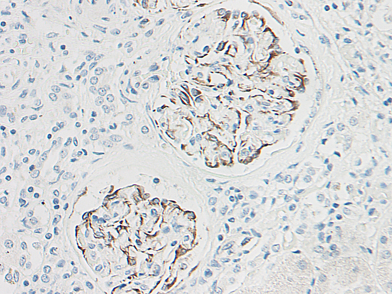 This antibody stained formalin-fixed, paraffin-embedded sections of human normal kidney. The recommended concentration is 0.5 ug/ml with an overnight incubation at 4&#730;C. An HRP-labeled polymer detection system was used with a DAB chromogen. Heat induced antigen retrieval with a pH 6.0 Sodium Citrate buffer is recommended. Optimal concentrations and conditions may vary.