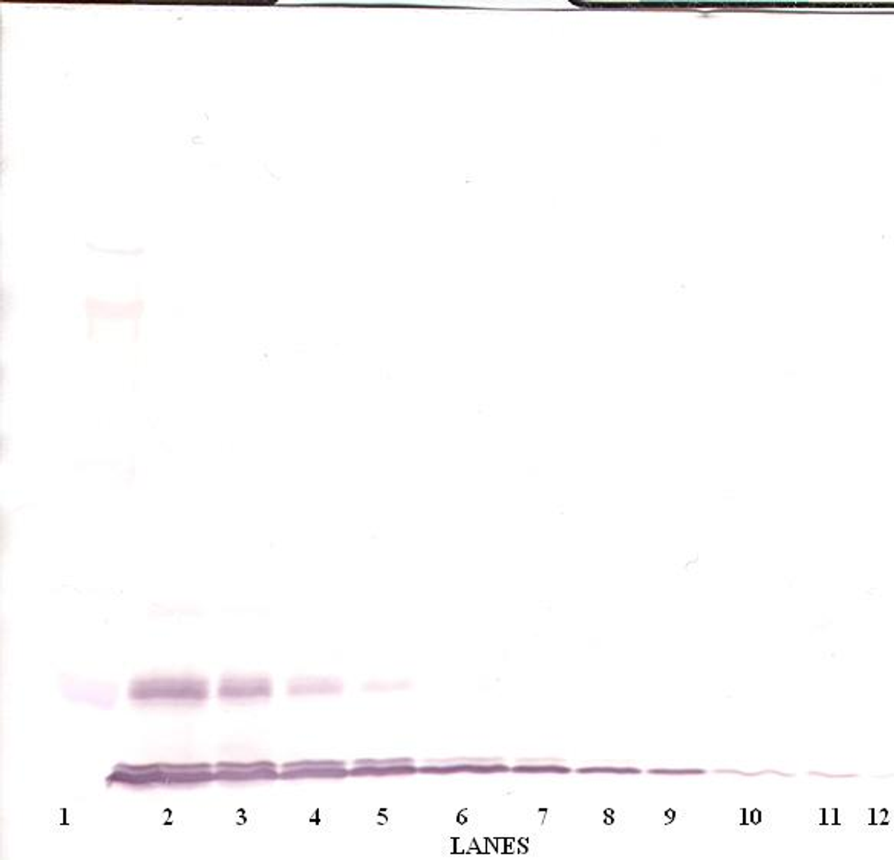 To detect hMCP-1 (MCAF) by Western Blot analysis this antibody can be used at a concentration of 0.1-0.2 ug/ml. Used in conjunction with compatible secondary reagents the detection limit for recombinant hMCP-1 (MCAF) is 1.5-3.0 ng/lane, under either reducing or non-reducing conditions.