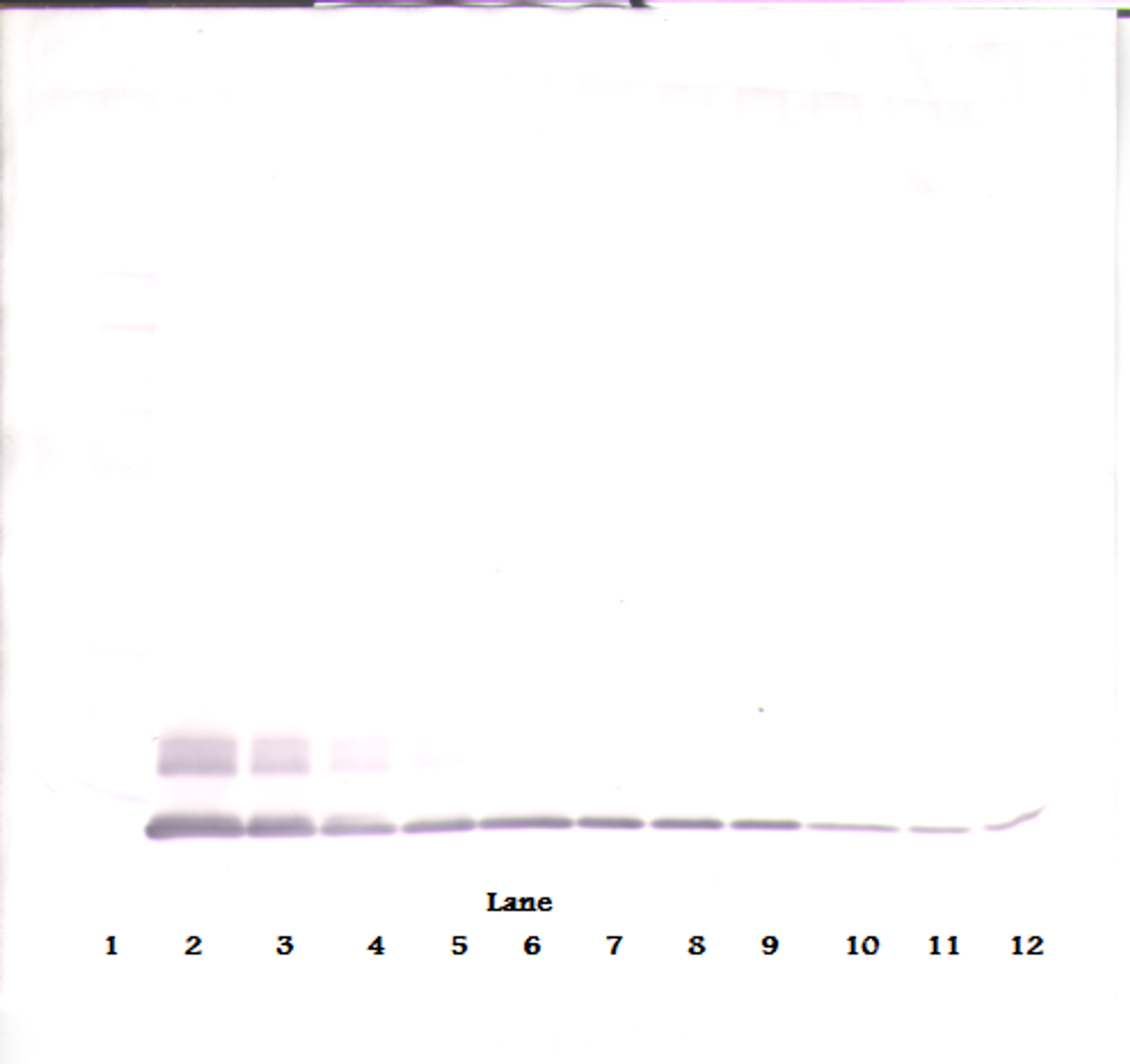 To detect hMCP-2 by Western Blot analysis this antibody can be used at a concentration of 0.1-0.2 ug/ml. Used in conjunction with compatible secondary reagents the detection limit for recombinant hMCP-2 is 1.5-3.0 ng/lane, under either reducing or non-reducing conditions.