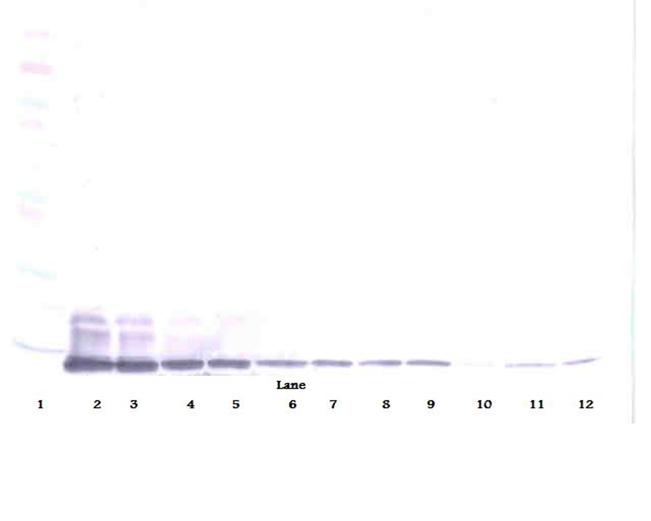 To detect mMCP-3 by Western Blot analysis this antibody can be used at a concentration of 0.1 - 0.2 ug/ml. Used in conjunction with compatible secondary reagents the detection limit for recombinant mMCP-3 is 1.5 - 3.0 ng/lane, under either reducing or non-reducing conditions.