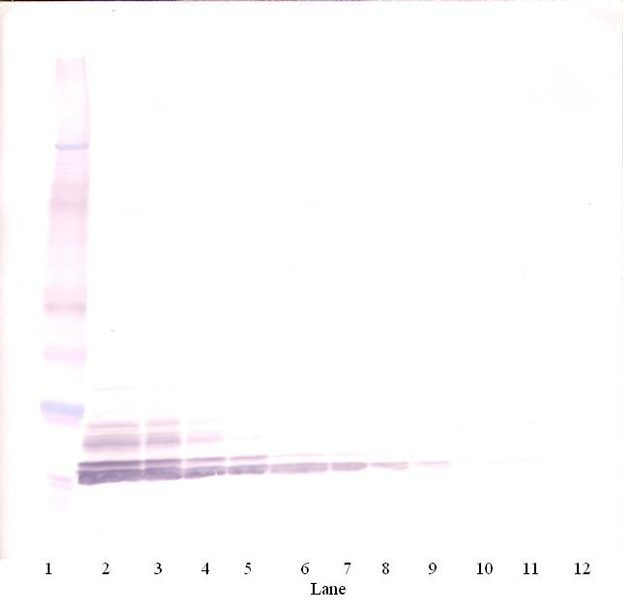 To detect Human MIP-1-alpha by Western Blot analysis this antibody can be used at a concentration of 0.1-0.2 ug/ml. When used in conjunction with compatible secondary reagents, the detection limit for recombinant Human MIP-1-alpha is 1.5-3.0 ng/lane, under either reducing or non-reducing conditions.