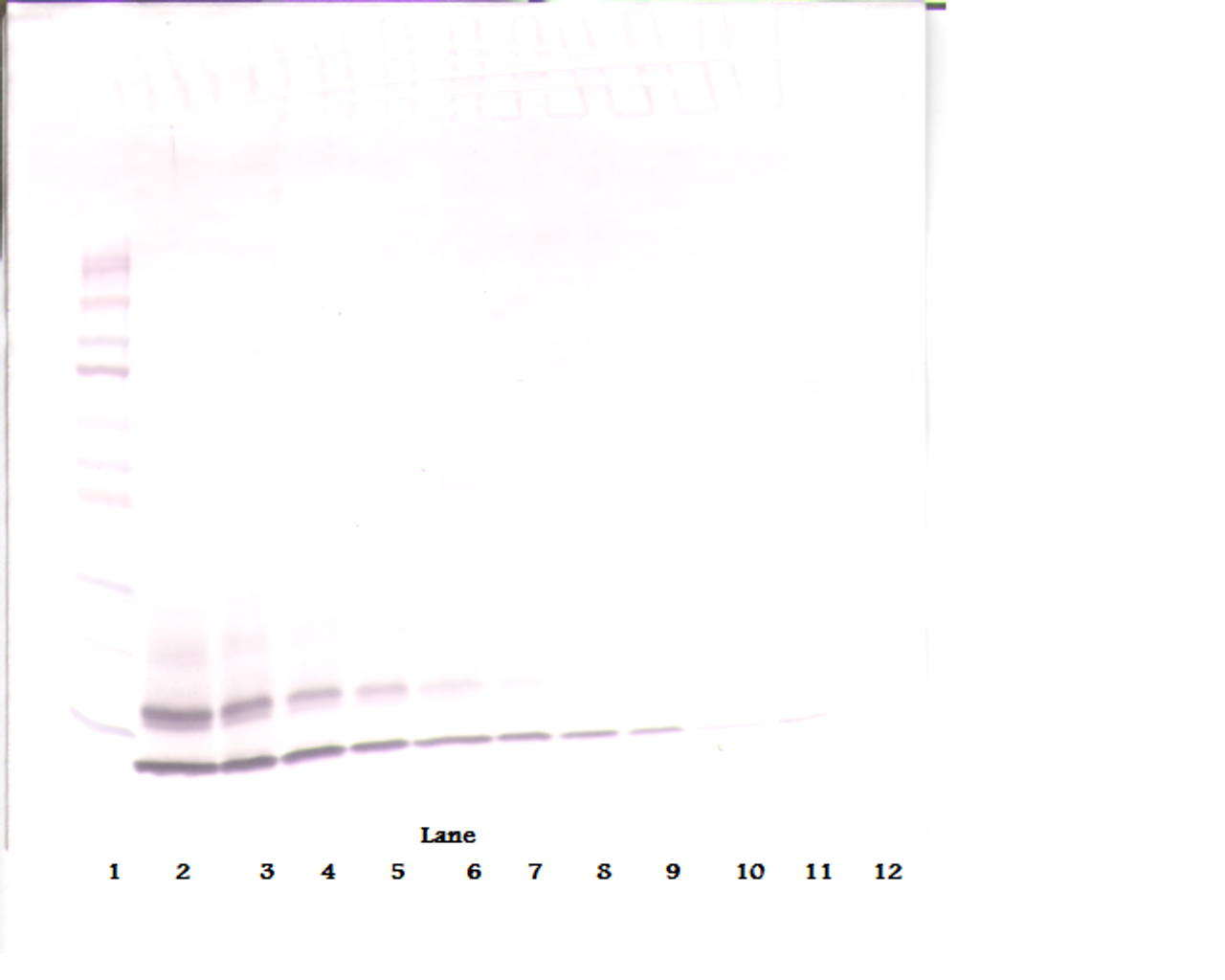 To detect Human MIP-1-beta by Western Blot analysis this antibody can be used at a concentration of 0.1-0.2 ug/ml. When used in conjunction with compatible secondary reagents, the detection limit for recombinant Human MIP-1-beta is 1.5-3.0 ng/lane, under either reducing or non-reducing conditions.