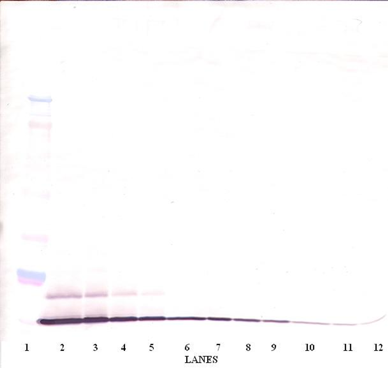 To detect HumanMIP-3-alpha by Western Blot analysis this antibody can be used at a concentration of 0.1-0.2 ug/ml. When used in conjunction with compatible secondary reagents, the detection limit for recombinant Human MIP-3-alpha is 1.5-3.0 ng/lane, under either reducing or non-reducing conditions.