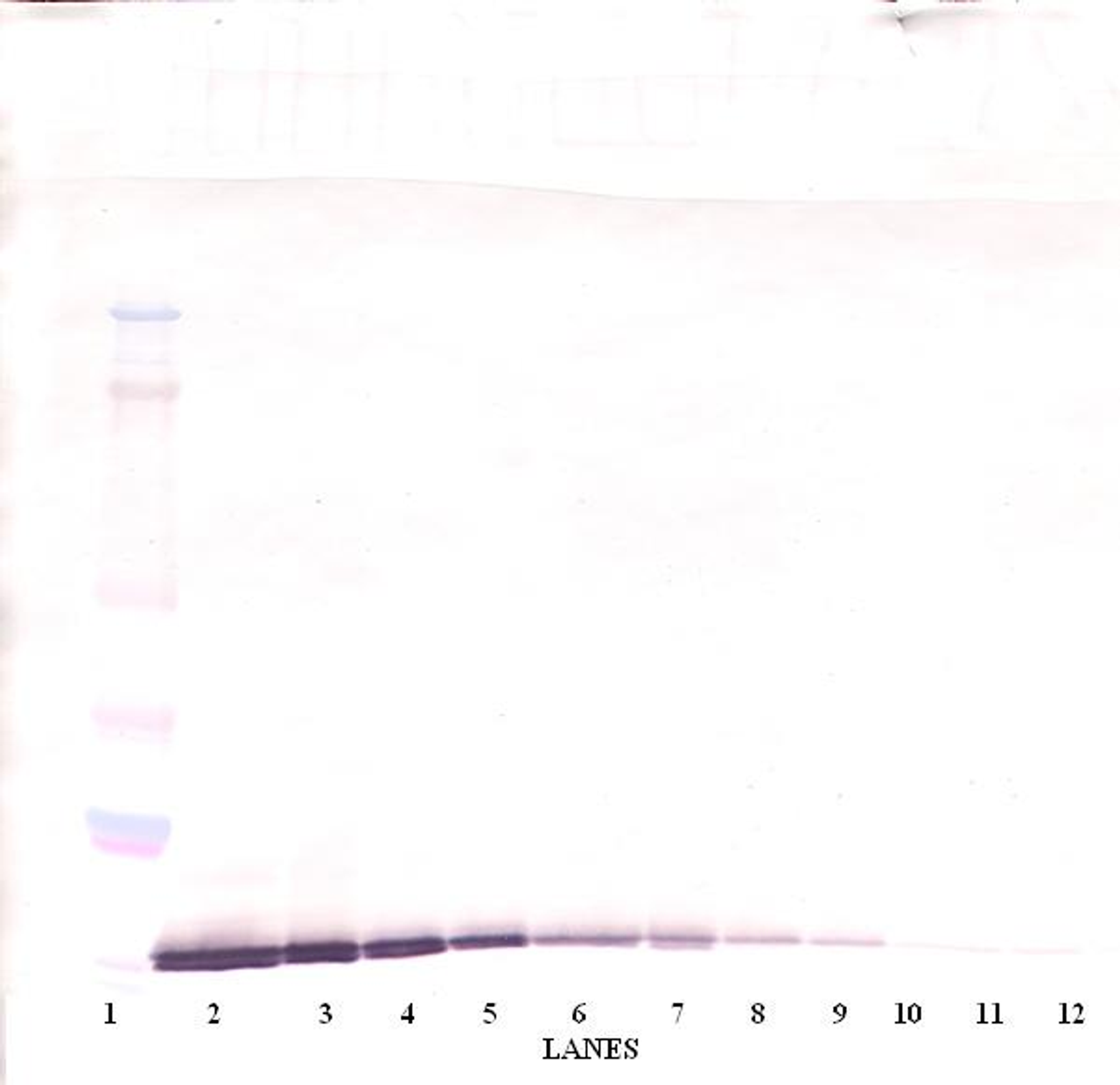 To detect Human MIP-3-beta by Western Blot analysis this antibody can be used at a concentration of 0.1-0.2 ug/ml. Used in conjunction with compatible secondary reagents the detection limit for recombinant Human MIP-3-beta is 1.5 - 3.0 ng/lane, under either reducing or non-reducing conditions.