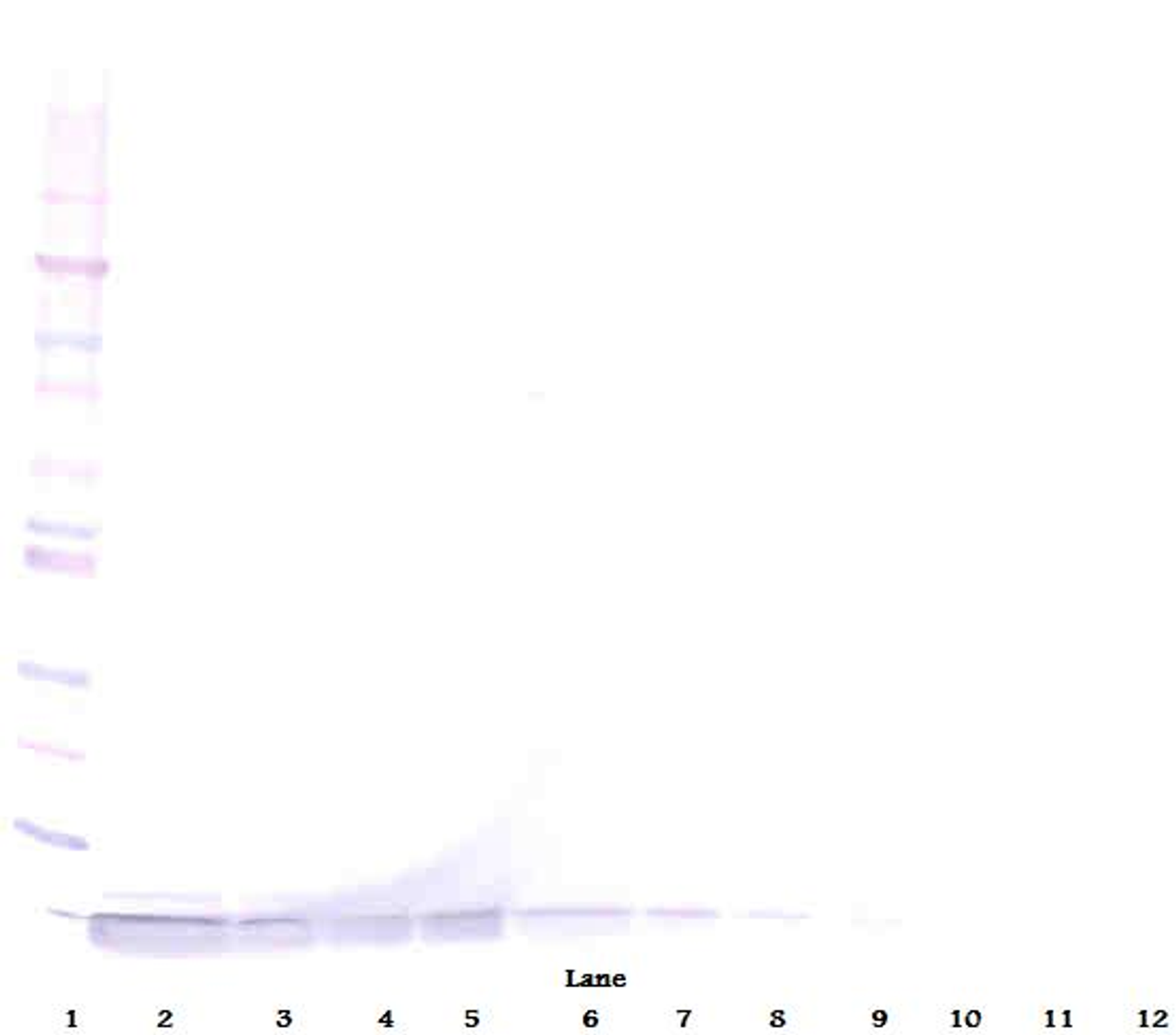 To detect hNP-1 by Western Blot analysis this antibody can be used at a concentration of 0.1- 0.2 ug/ml. Used in conjunction with compatible secondary reagents the detection limit for recombinant hNP-1 is 1.5-3.0 ng/lane, under either reducing or non-reducing conditions.