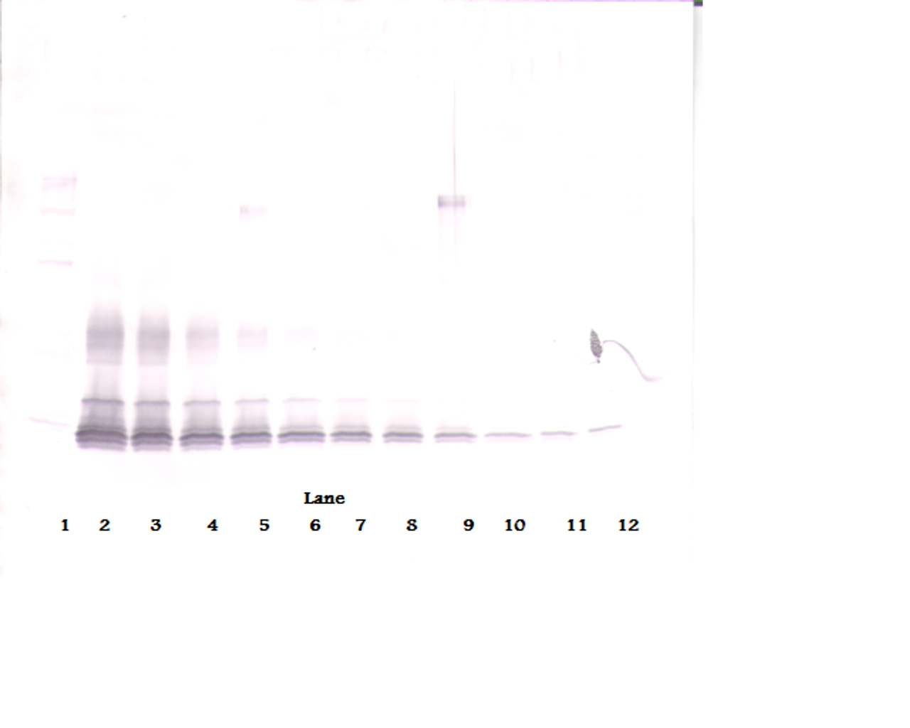 To detect hPDGF-BB by Western Blot analysis this antibody can be used at a concentration of 0.1 - 0.2 ug/ml. Used in conjunction with compatible secondary reagents the detection limit for recombinant hPDGF-BB is 1.5 - 3.0 ng/lane, under either reducing or non-reducing conditions.