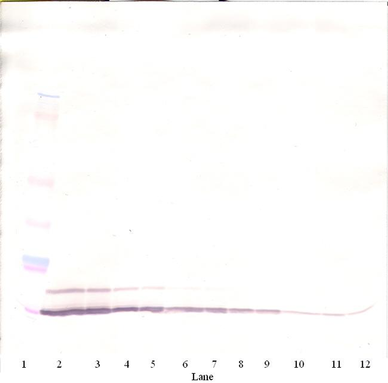 To detect Rat RANTES by Western Blot analysis this antibody can be used at a concentration of 0.1-0.2 ug/ml. Used in conjunction with compatible secondary reagents the detection limit for recombinant Rat RANTES is 1.5-3.0 ng/lane, under either reducing or non-reducing conditions.