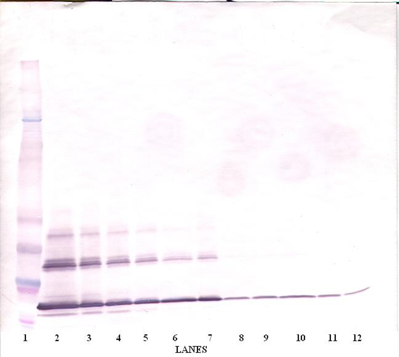 To detect hsCD40L by Western Blot analysis this antibody can be used at a concentration of 0.1 - 0.2 ug/ml. Used in conjunction with compatible secondary reagents the detection limit for recombinant hsCD40L is 1.5 - 3.0 ng/lane, under either reducing or non-reducing conditions.