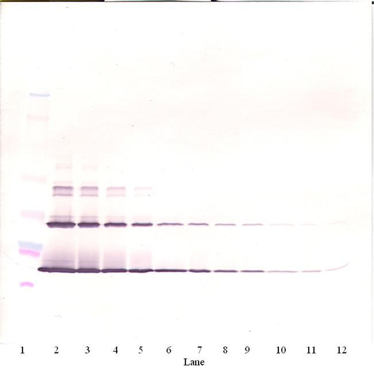 To detect hSCF by Western Blot analysis this antibody can be used at a concentration of 0.1-0.2 ug/ml. Used in conjunction with compatible secondary reagents the detection limit for recombinant hSCF is 1.5-3.0 ng/lane, under either reducing or non-reducing conditions.