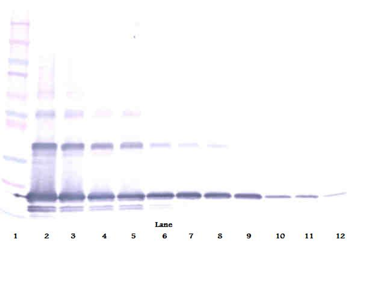 To detect hsRANKL by Western Blot analysis this antibody can be used at a concentration of 0.1-0.2 ug/ml. Used in conjunction with compatible secondary reagents the detection limit for recombinant hsRANKL is 1.5-3.0 ng/lane, under either reducing or non-reducing conditions.
