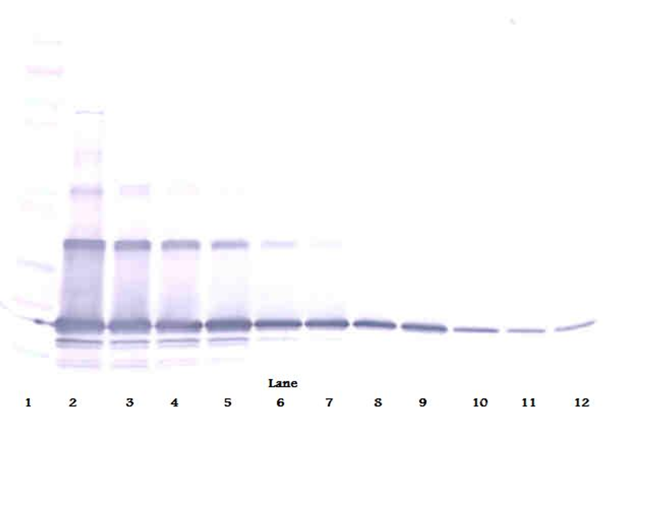 To detect hsRANKL by Western Blot analysis this antibody can be used at a concentration of 0.1 - 0.2 ug/ml. Used in conjunction with compatible secondary reagents the detection limit for recombinant hsRANKL is 1.5 - 3.0 ng/lane, under either reducing or non-reducing conditions.