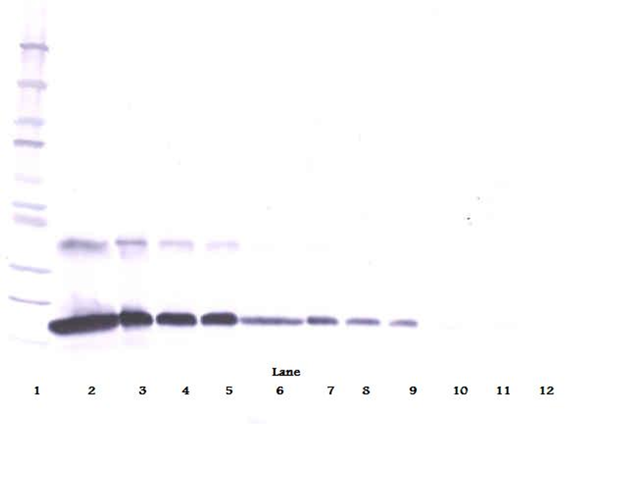 To detect hsTNF-receptor by Western Blot analysis this antibody can be used at a concentration of 0.1- 0.2 ug/ml. Used in conjunction with compatible secondary reagents the detection limit for recombinant hsTNF-receptor is 1.5-3.0 ng/lane, under either reducing or non-reducing conditions.