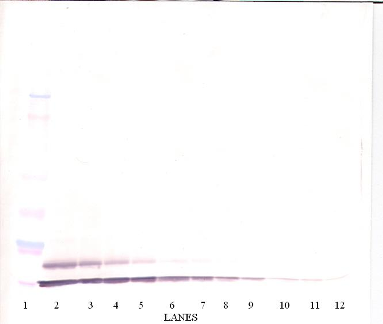 To detect hTARC by Western Blot analysis this antibody can be used at a concentration of 0.1 - 0.2 ug/ml. Used in conjunction with compatible secondary reagents the detection limit for recombinant hTARC is 1.5 - 3.0 ng/lane, under either reducing or non-reducing conditions.