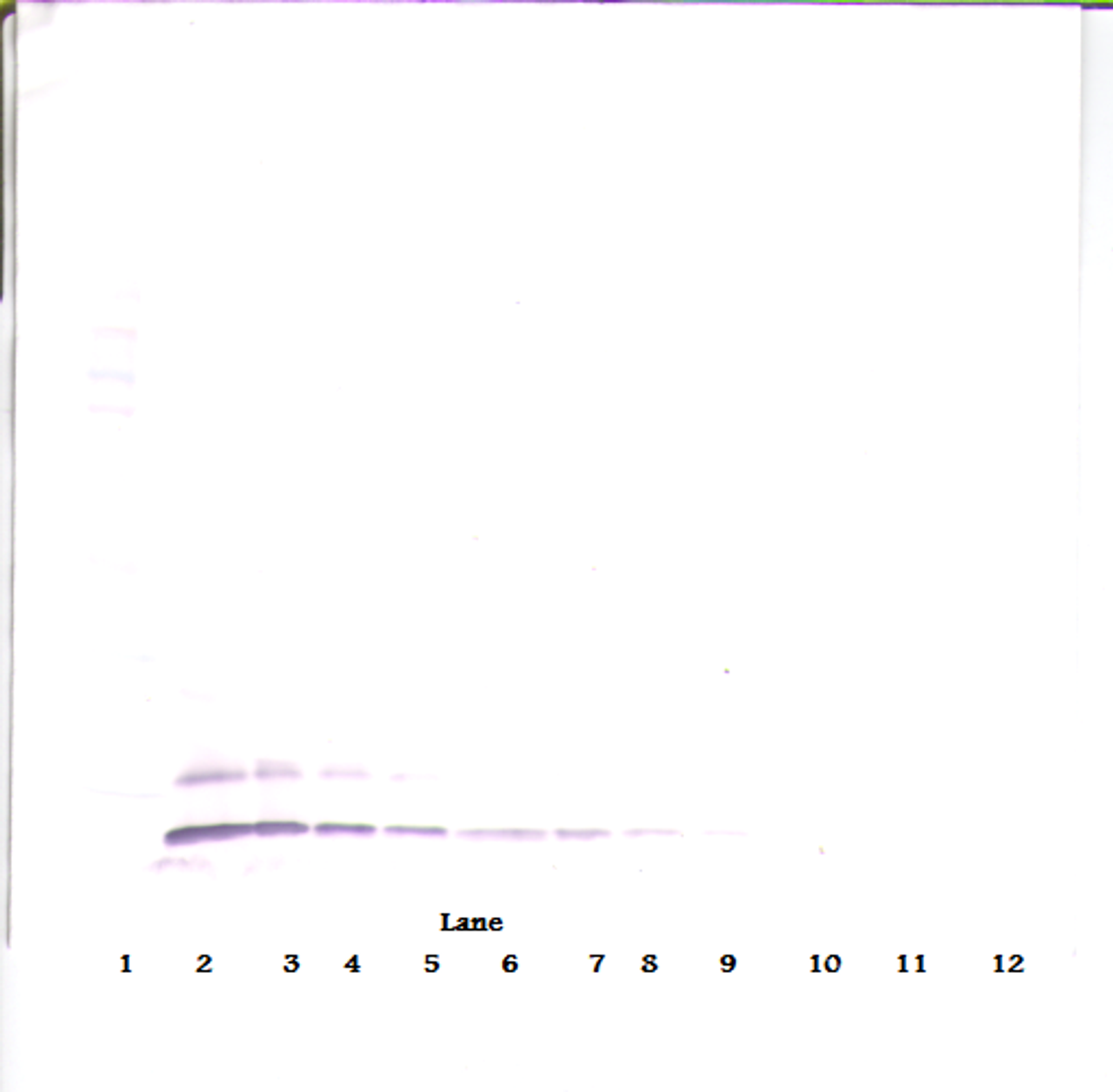 To detect hTARC by Western Blot analysis this antibody can be used at a concentration of 0.1 - 0.2 ug/ml. Used in conjunction with compatible secondary reagents the detection limit for recombinant hTARC is 1.5 - 3.0 ng/lane, under either reducing or non-reducing conditions.